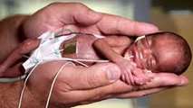 روز جهانی نوزاد نارس